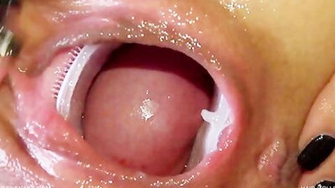 借用道具来给你窥探子宫看看子宫石怎么把卵排出来