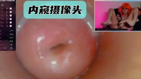 内窥摄像头