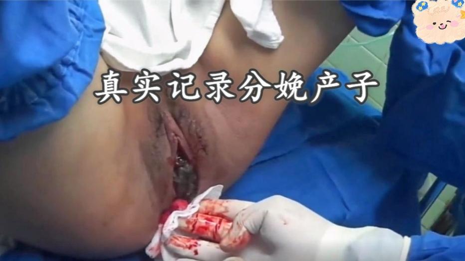 慎点重口味医院内部分娩产子视频流出