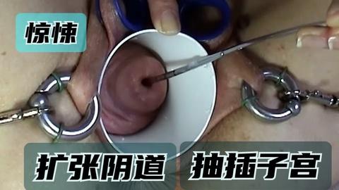 扩张阴道抽插子宫