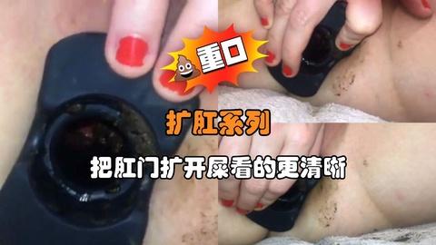 扩肛系列把肛门扩开屎看的更清晰