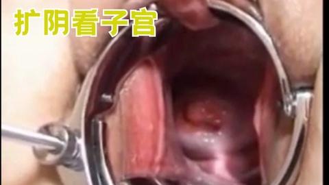 扩阴看子宫