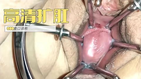极限扩阴玩弄子宫