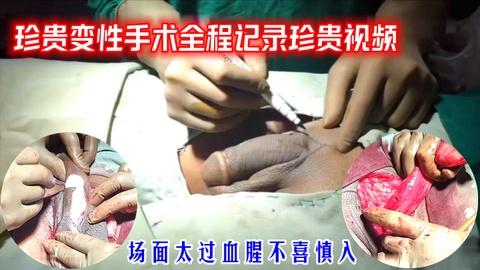 珍惜变性手术全程详细记录珍贵视频3