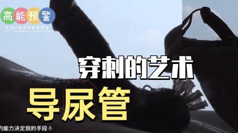 穿刺与导尿管的艺术《1》