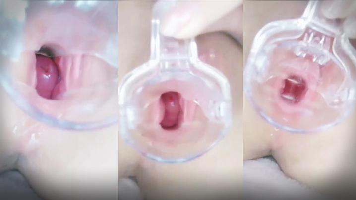 窥探骚穴让我们用工具把我的骚穴撑开看看里面张什么样子的都有些什么奥秘