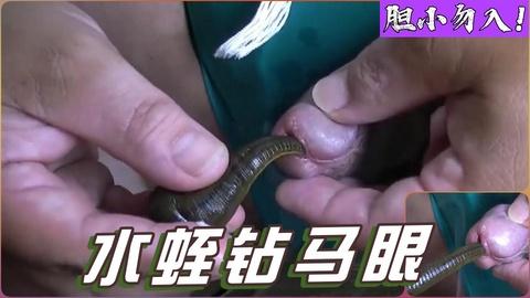 蚂蝗钻进马眼极度重口慎入